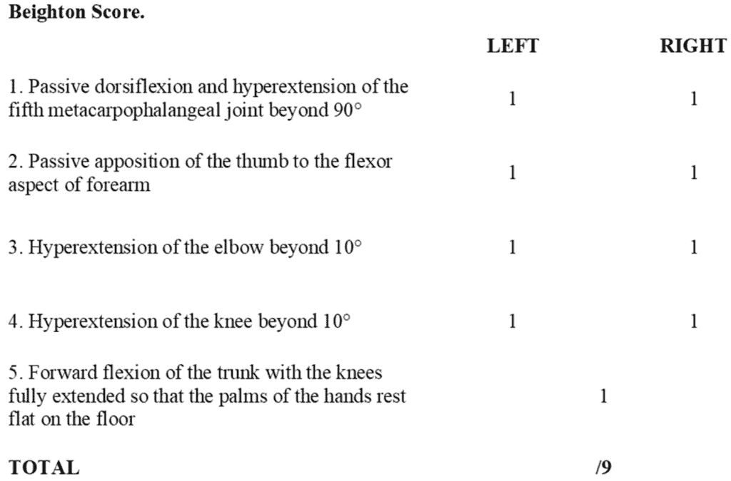 Beighton score table